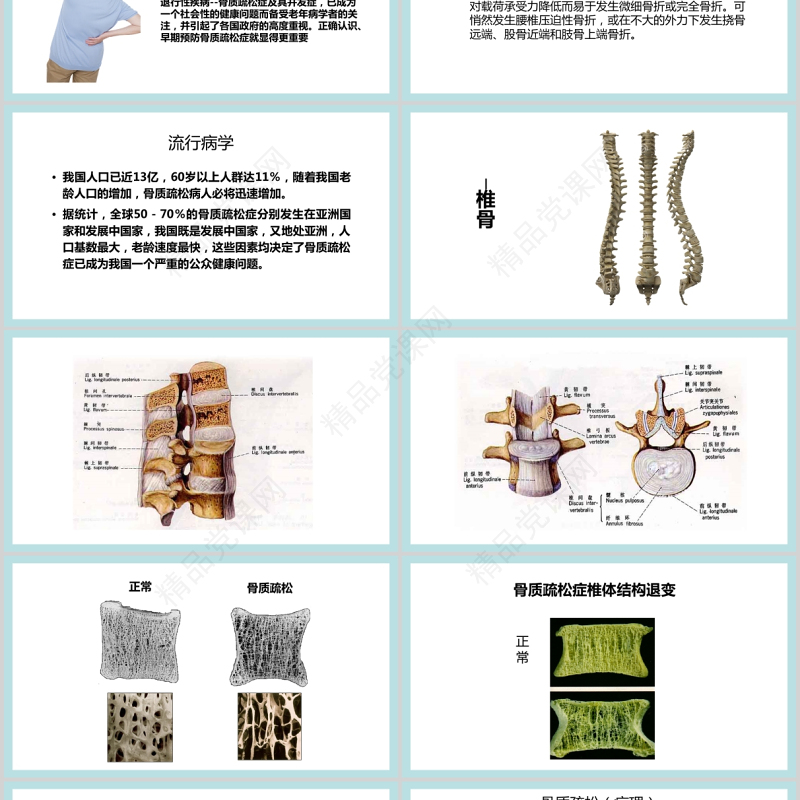 年10月20日世界骨质疏松日PPT极简时尚骨质疏松防治关注骨骼健康医疗科普知识宣传课件