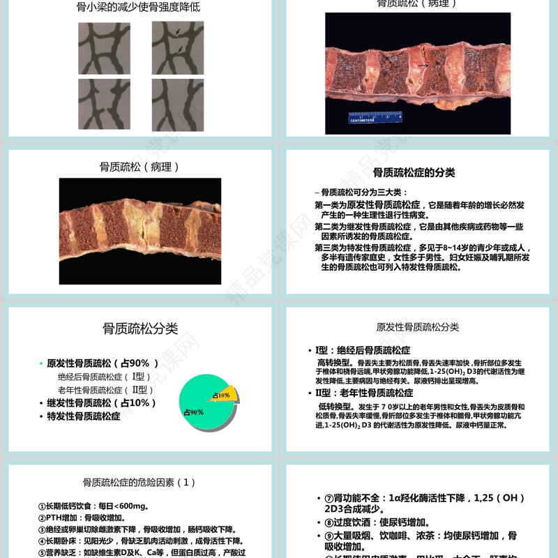 年10月20日世界骨质疏松日PPT极简时尚骨质疏松防治关注骨骼健康医疗科普知识宣传课件