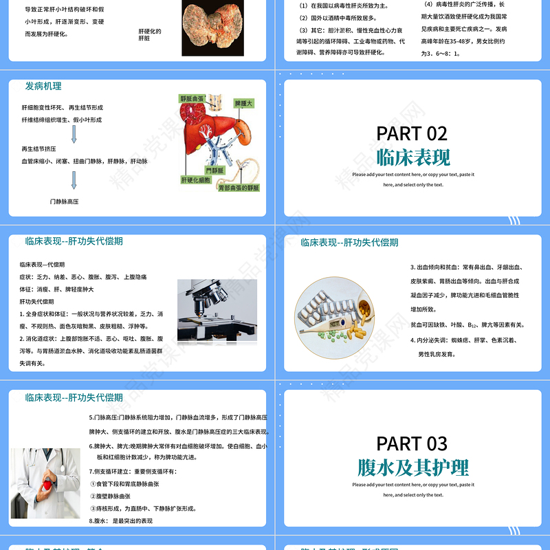 肝硬化腹水病人的护理PPT扁平医疗风医学护理通用PPT