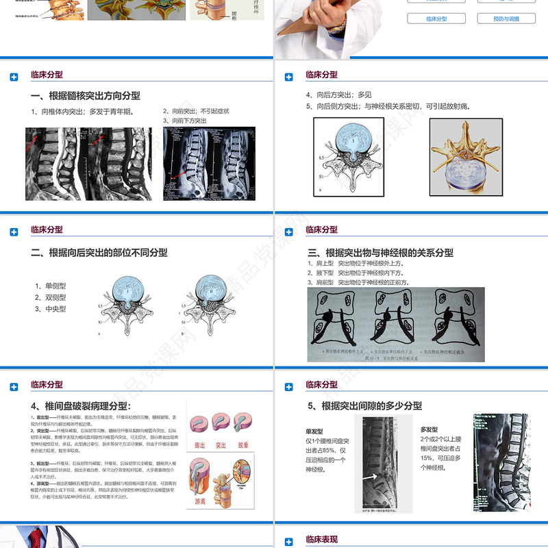 腰椎间盘突出症诊断与治疗PPT清新商务医疗风医学通用PPT模板
