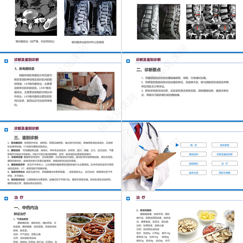 腰椎间盘突出症诊断与治疗PPT清新商务医疗风医学通用PPT模板