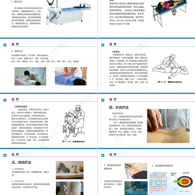腰椎间盘突出症诊断与治疗PPT清新商务医疗风医学通用PPT模板