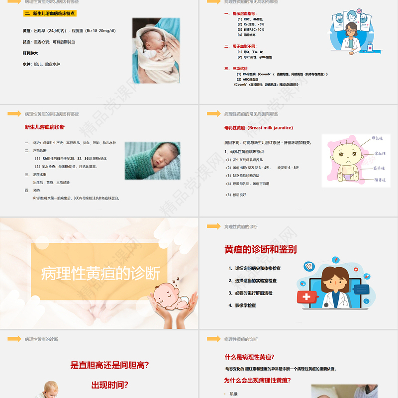 新生儿黄疸护理PPT创意简约医学行业通用PPT